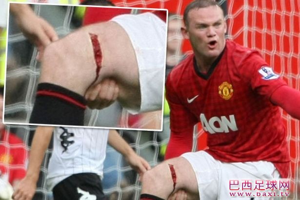 Wayne Rooney leg injury.jpg