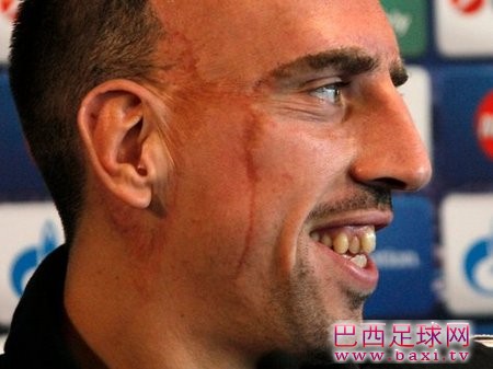 里贝里：感觉已经好些，盼周中登场