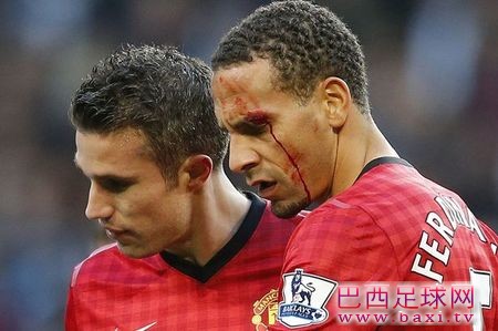 PFA主席：要等球员瞎眼后再采取措施吗？