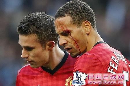 维迪奇：有激情是好事，但不能转化成暴力